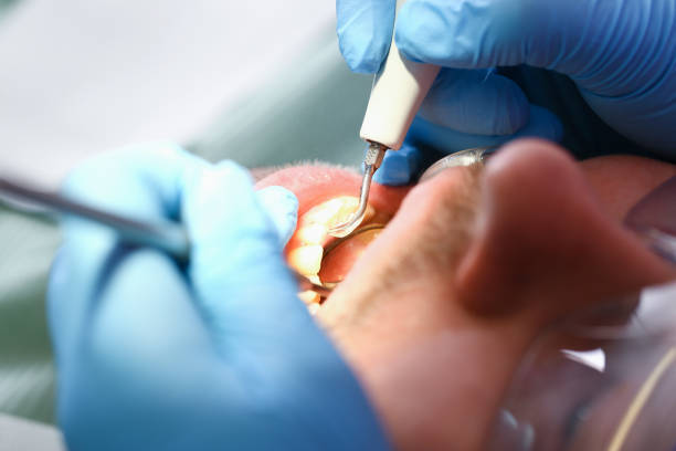 Best Cracked Tooth Emergency Dentist  in Park City, KS