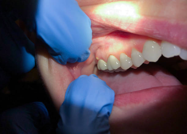 Best Emergency Dental Services Near Me  in Park City, KS