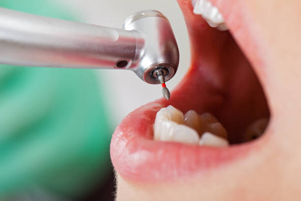 Best Tooth Infection Emergency Dentist  in Park City, KS